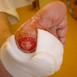 page-wondbehandeling1